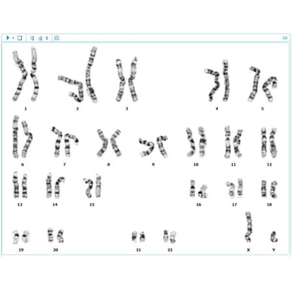 Chromosome Analysis Systems Argenit Smart Information Technologies