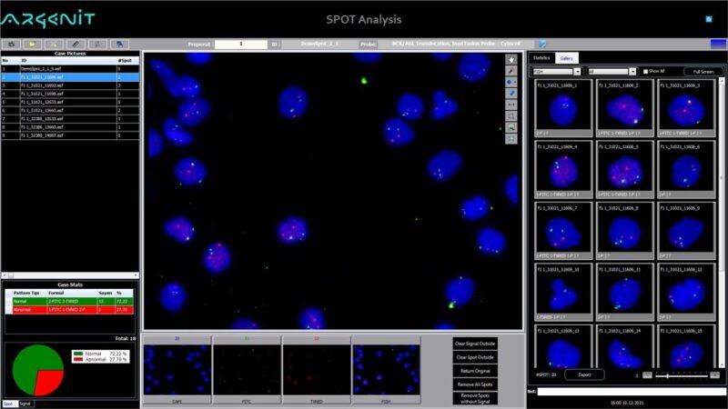 FISH Analysis Systems Argenit Smart Information Technologies